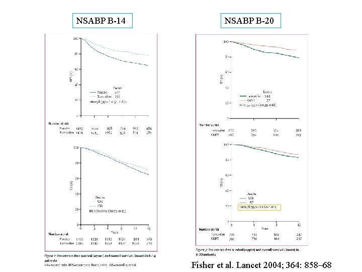 NSABP B-14 NSABP B-20 Fisher et al. Lancet 2004; 364: 858– 68 NSABP B-14 NSABP B-20 Fisher et al. Lancet 2004; 364: 858– 68