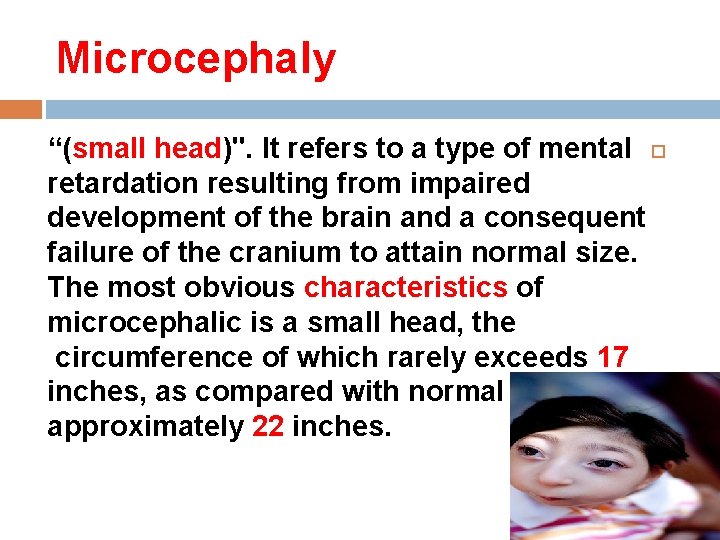 Microcephaly “(small head)". It refers to a type of mental retardation resulting from impaired Microcephaly “(small head)". It refers to a type of mental retardation resulting from impaired