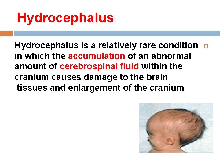 Hydrocephalus is a relatively rare condition in which the accumulation of an abnormal amount Hydrocephalus is a relatively rare condition in which the accumulation of an abnormal amount