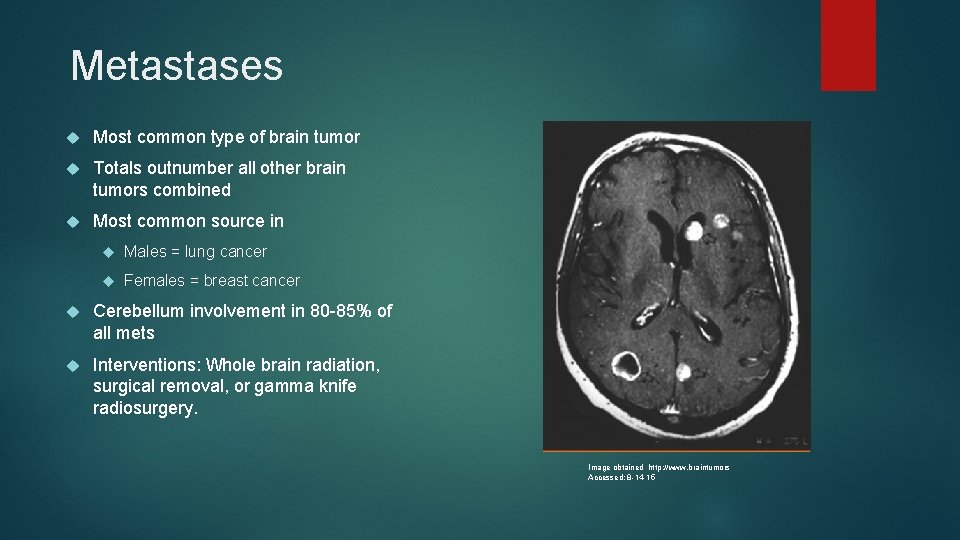 Metastases Most common type of brain tumor Totals outnumber all other brain tumors combined