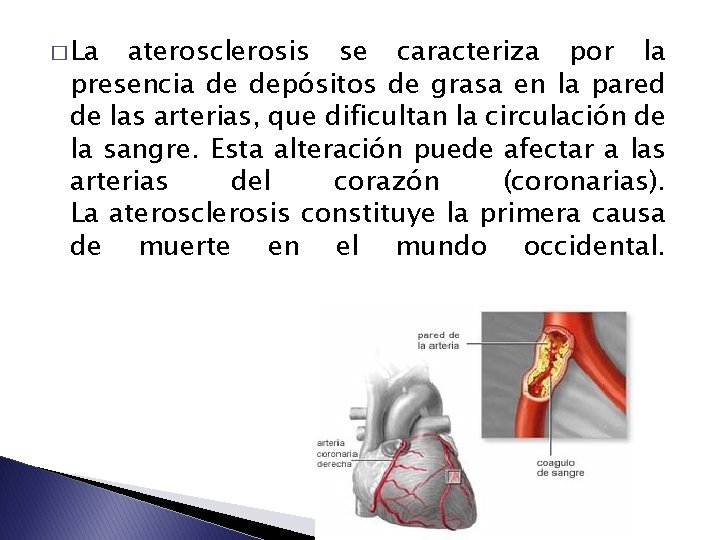 � La aterosclerosis se caracteriza por la presencia de depósitos de grasa en la � La aterosclerosis se caracteriza por la presencia de depósitos de grasa en la