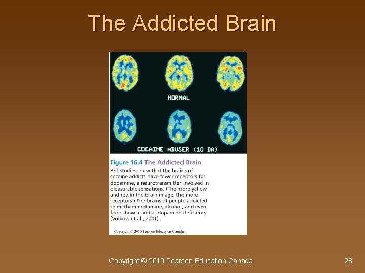 The Addicted Brain Copyright © 2010 Pearson Education Canada 28 