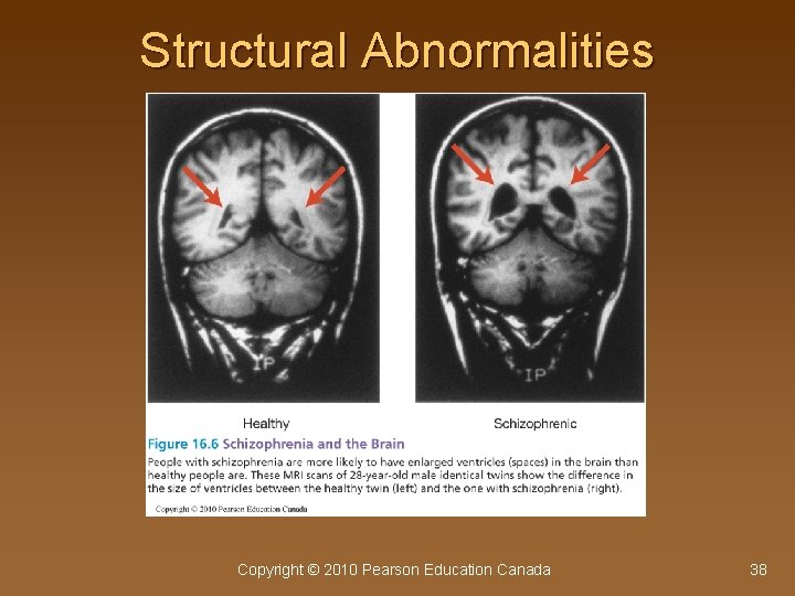 Structural Abnormalities Copyright © 2010 Pearson Education Canada 38 