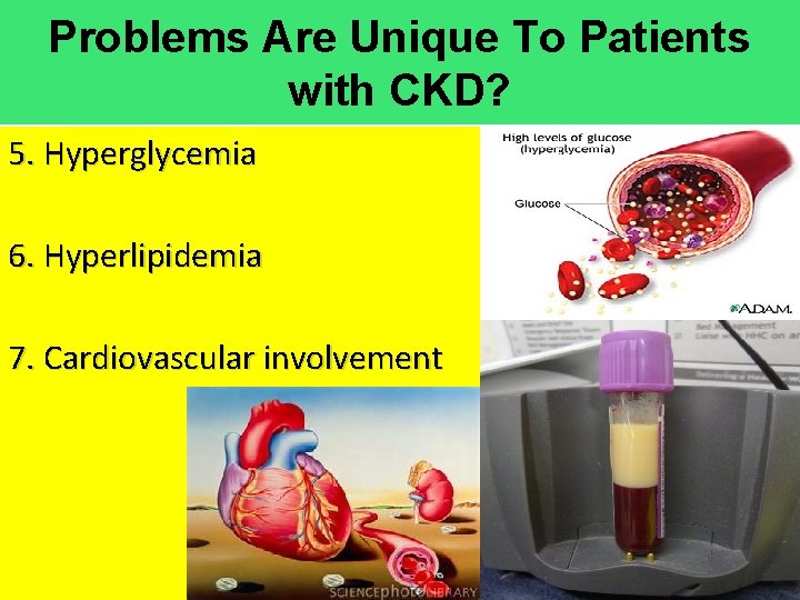 Problems Are Unique To Patients with CKD? 5. Hyperglycemia 6. Hyperlipidemia 7. Cardiovascular involvement