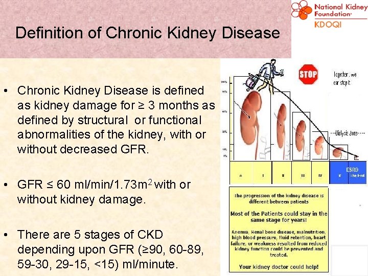 Definition of Chronic Kidney Disease • Chronic Kidney Disease is defined as kidney damage