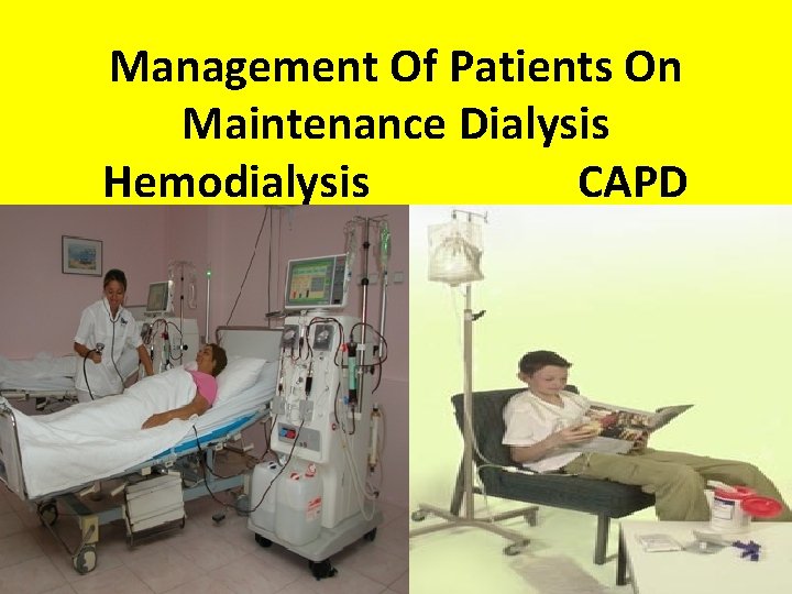 Management Of Patients On Maintenance Dialysis Hemodialysis CAPD 