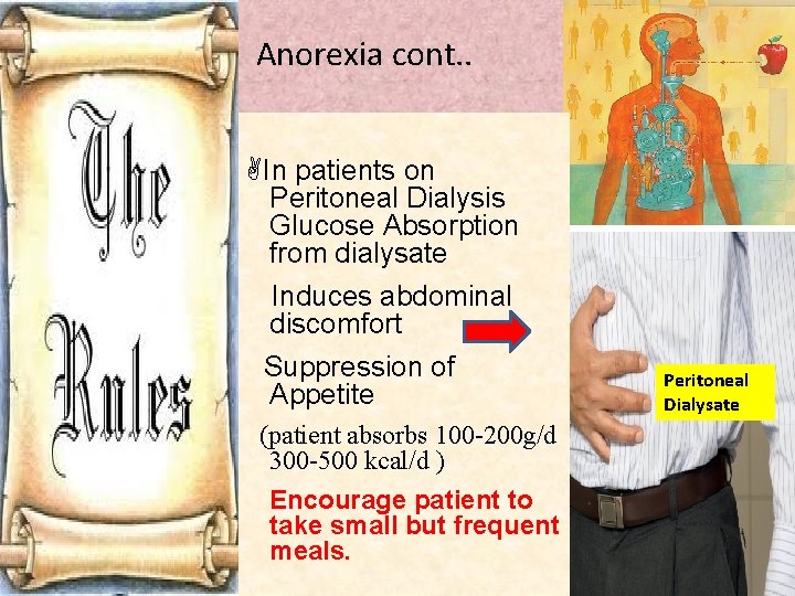  Anorexia cont. . In patients on Peritoneal Dialysis Glucose Absorption from dialysate Induces