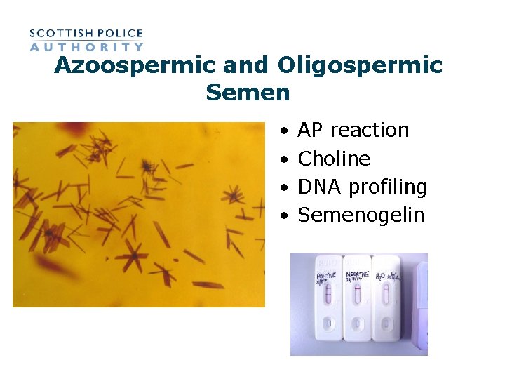 Azoospermic and Oligospermic Semen • • AP reaction Choline DNA profiling Semenogelin 