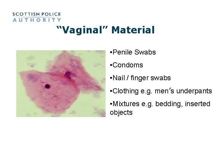“Vaginal” Material • Penile Swabs • Condoms • Nail / finger swabs • Clothing “Vaginal” Material • Penile Swabs • Condoms • Nail / finger swabs • Clothing