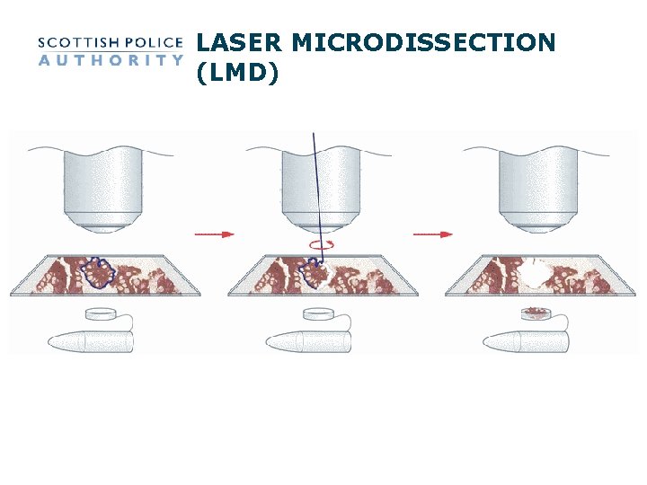 LASER MICRODISSECTION (LMD) LASER MICRODISSECTION (LMD)