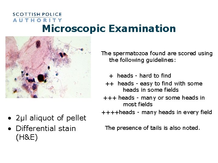 Microscopic Examination The spermatozoa found are scored using the following guidelines: • 2µl aliquot