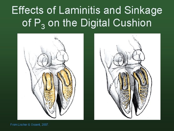 Effects of Laminitis and Sinkage of P 3 on the Digital Cushion From Lischer