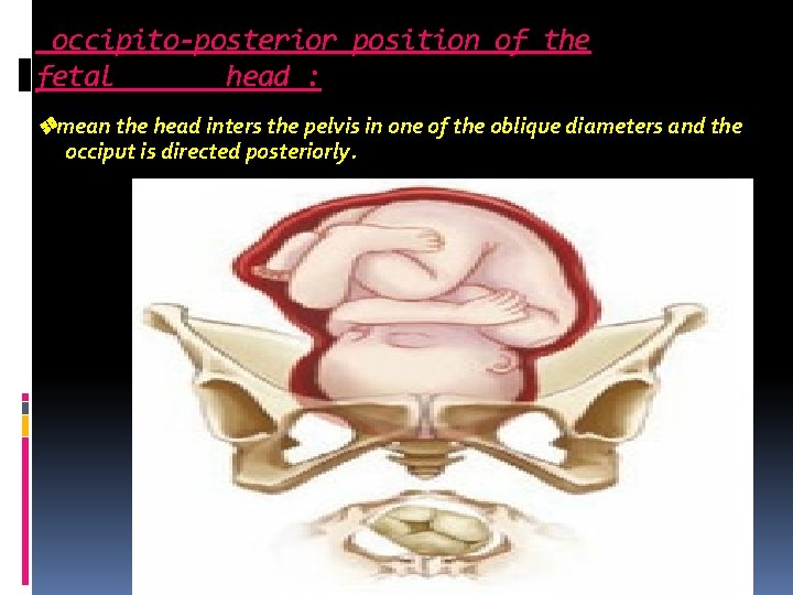 occipito-posterior position of the fetal head : mean the head inters the pelvis in