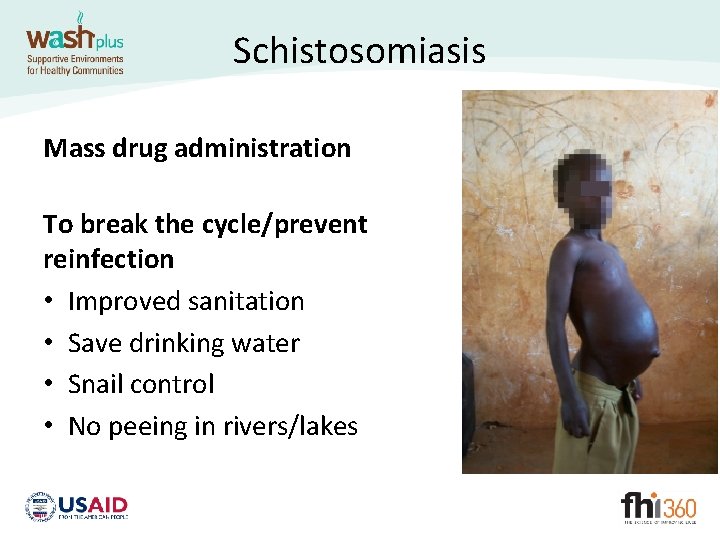 Schistosomiasis Mass drug administration To break the cycle/prevent reinfection • Improved sanitation • Save