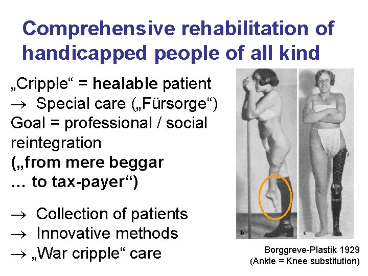 Comprehensive rehabilitation of handicapped people of all kind „Cripple“ = healable patient Special care Comprehensive rehabilitation of handicapped people of all kind „Cripple“ = healable patient Special care