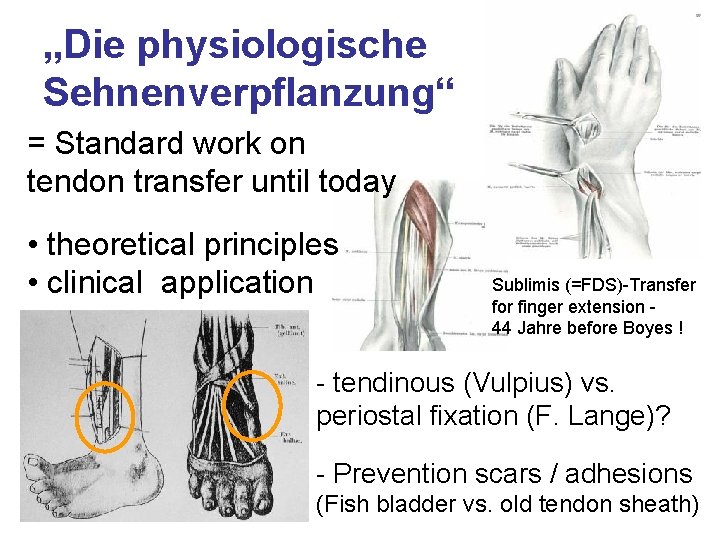 „Die physiologische Sehnenverpflanzung“ = Standard work on tendon transfer until today • theoretical principles „Die physiologische Sehnenverpflanzung“ = Standard work on tendon transfer until today • theoretical principles