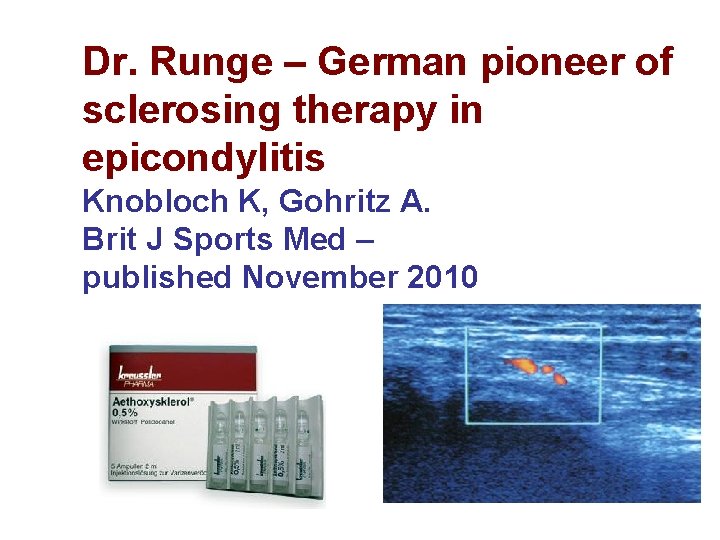 Dr. Runge – German pioneer of sclerosing therapy in epicondylitis Knobloch K, Gohritz A. Dr. Runge – German pioneer of sclerosing therapy in epicondylitis Knobloch K, Gohritz A.