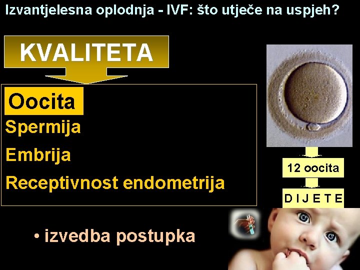 Izvantjelesna oplodnja - IVF: što utječe na uspjeh? KVALITETA Oocita Spermija Embrija Receptivnost endometrija