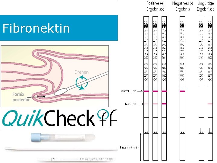 Fibronektin 