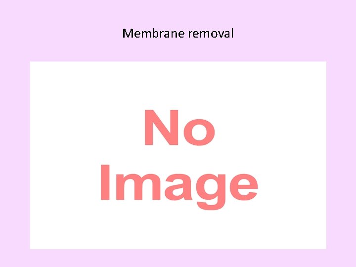 Membrane removal 