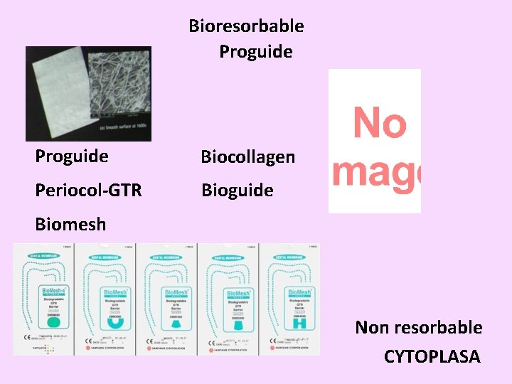 Bioresorbable Proguide Biocollagen Periocol-GTR Bioguide Biomesh Non resorbable CYTOPLASA 