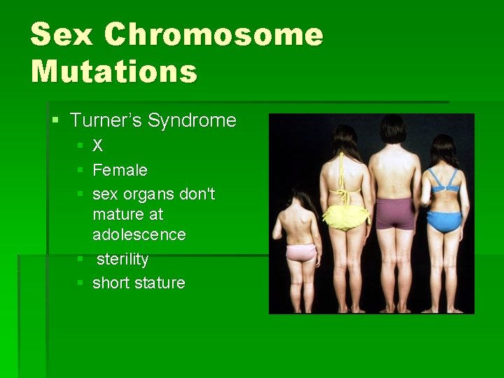 Sex Chromosome Mutations § Turner’s Syndrome § X § Female § sex organs don't