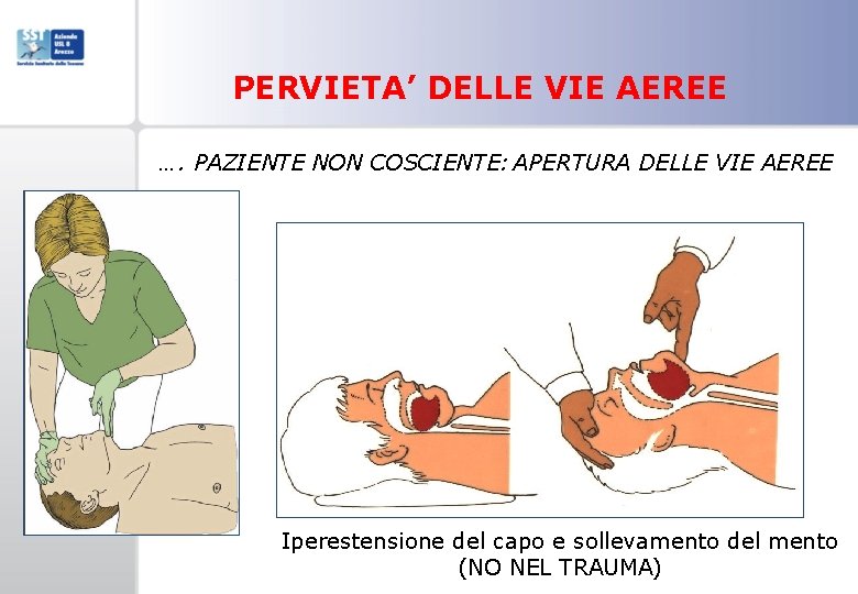 PERVIETA’ DELLE VIE AEREE …. PAZIENTE NON COSCIENTE: APERTURA DELLE VIE AEREE Iperestensione del