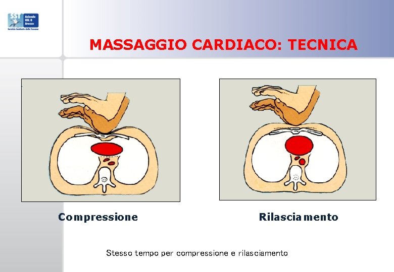 MASSAGGIO CARDIACO: TECNICA Compressione Rilasciamento Stesso tempo per compressione e rilasciamento 