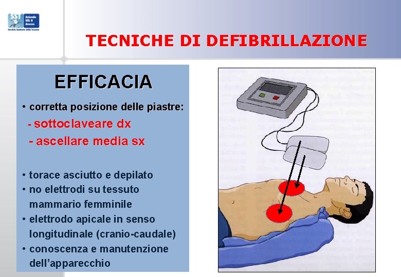 TECNICHE DI DEFIBRILLAZIONE EFFICACIA • corretta posizione delle piastre: - sottoclaveare dx - ascellare