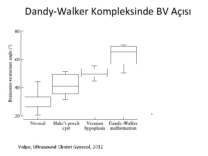 Dandy-Walker Kompleksinde BV Açısı Dandy-Walker; BVA>45°, Blake Poş Kisti; BVA < 30° Volpe, Ultrasound