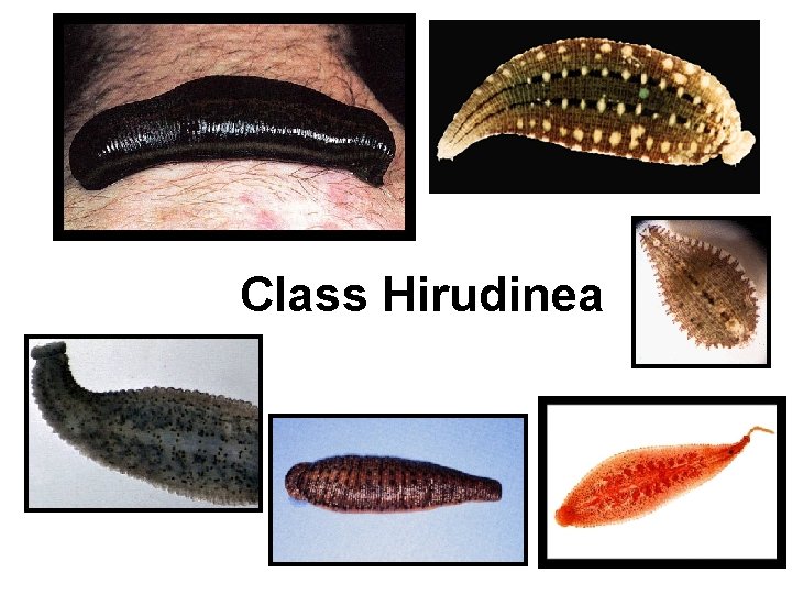 Class Hirudinea 