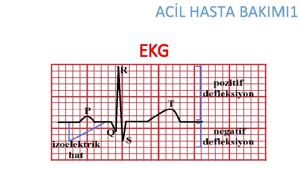 ACİL HASTA BAKIMI 1 EKG 