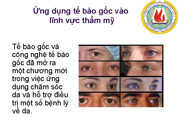 Ứng dụng tế bào gốc vào lĩnh vực thẩm mỹ Tế bào gốc và