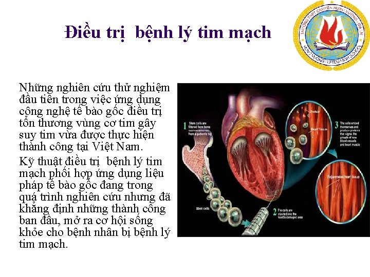 Điều trị bệnh lý tim mạch Những nghiên cứu thử nghiệm đầu tiên trong