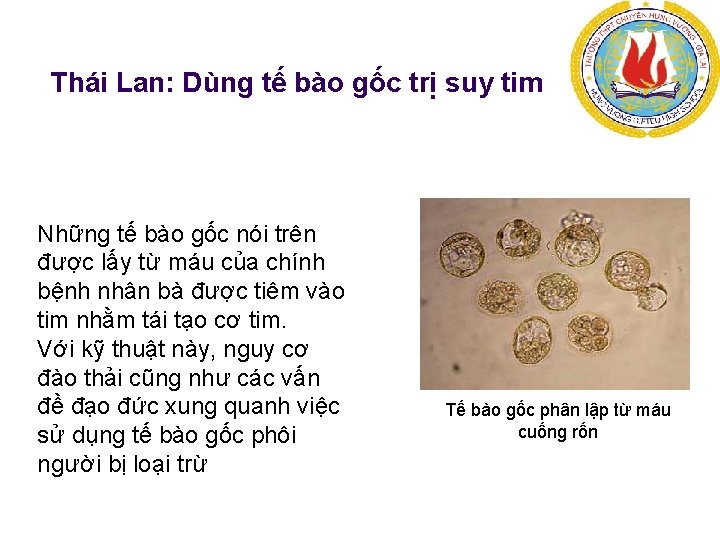 Thái Lan: Dùng tế bào gốc trị suy tim Những tế bào gốc nói