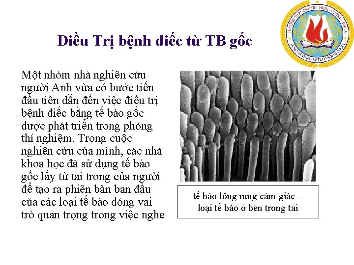 Điều Trị bệnh điếc từ TB gốc Một nhóm nhà nghiên cứu người Anh