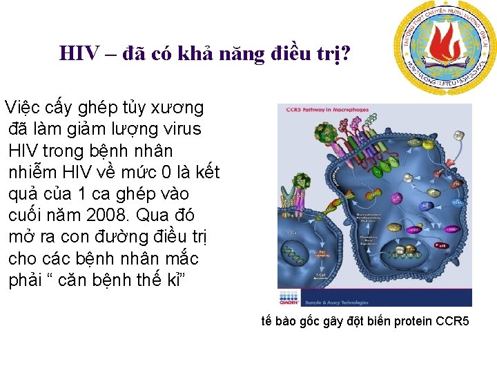 HIV – đã có khả năng điều trị? Việc cấy ghép tủy xương đã