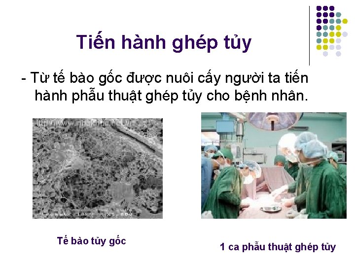 Tiến hành ghép tủy - Từ tế bào gốc được nuôi cấy người ta