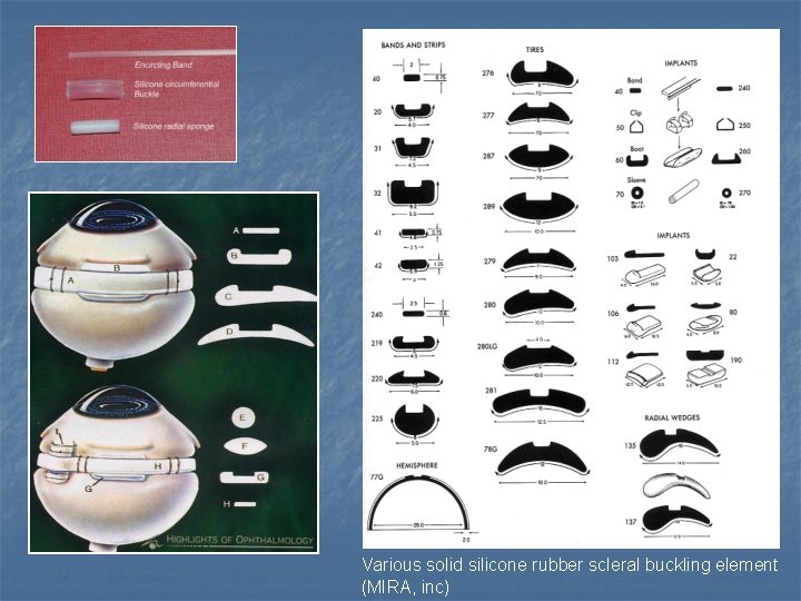 Various solid silicone rubber scleral buckling element (MIRA, inc) 