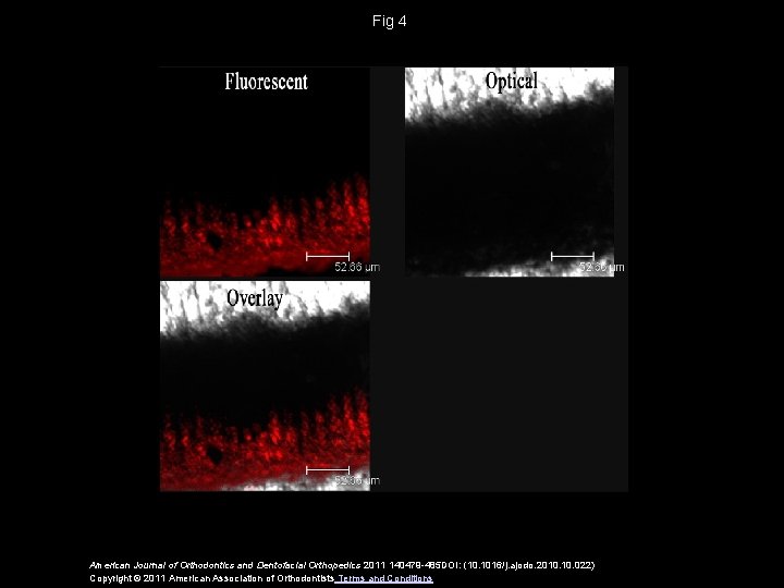 Fig 4 American Journal of Orthodontics and Dentofacial Orthopedics 2011 140479 -485 DOI: (10.