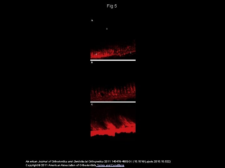 Fig 5 American Journal of Orthodontics and Dentofacial Orthopedics 2011 140479 -485 DOI: (10.
