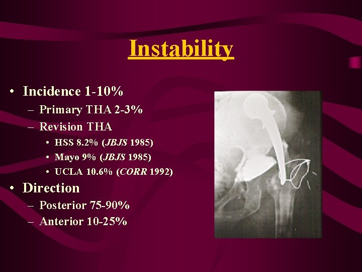 Instability • Incidence 1 -10% – Primary THA 2 -3% – Revision THA • Instability • Incidence 1 -10% – Primary THA 2 -3% – Revision THA •