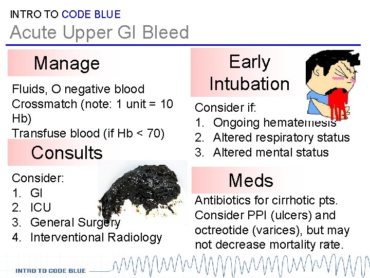 INTRO TO CODE BLUE Acute Upper GI Bleed Manage Fluids, O negative blood Crossmatch INTRO TO CODE BLUE Acute Upper GI Bleed Manage Fluids, O negative blood Crossmatch