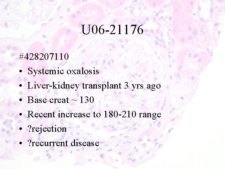U 06 -21176 #428207110 • Systemic oxalosis • Liver-kidney transplant 3 yrs ago •