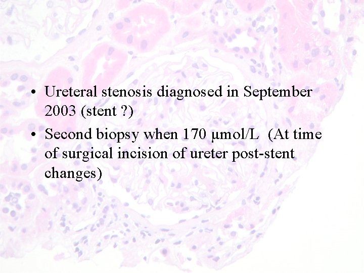  • Ureteral stenosis diagnosed in September 2003 (stent ? ) • Second biopsy