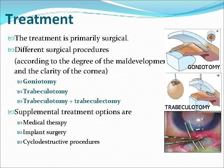 Treatment The treatment is primarily surgical. Different surgical procedures (according to the degree of