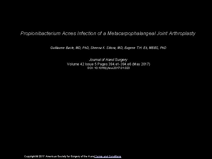 Propionibacterium Acnes Infection of a Metacarpophalangeal Joint Arthroplasty Guillaume Bacle, MD, Ph. D, Sheena
