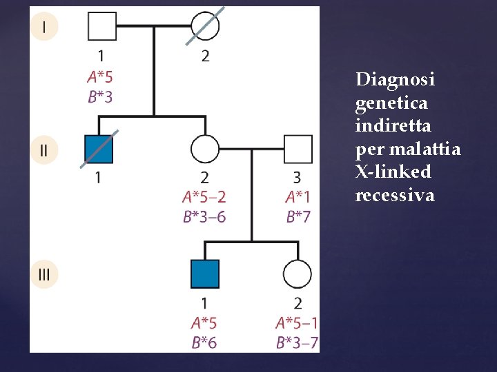 Diagnosi genetica indiretta per malattia X-linked recessiva 