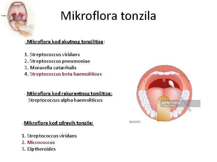 Mikroflora tonzila • Mikroflora kod akutnog tonzilitisa: 1. Streptococcus viridans 2. Streptococcus pneumoniae 3.