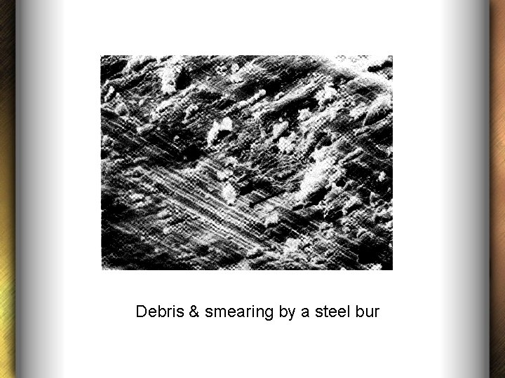 Debris & smearing by a steel bur 